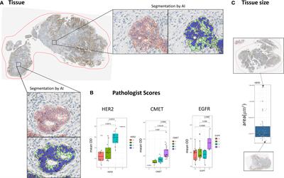 Spatial heterogeneity of cancer associated protein expression in immunohistochemically stained images as an improved prognostic biomarker